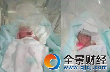 ɽ�|һ����10�컨��10�f ���p��̥�������İ�̥