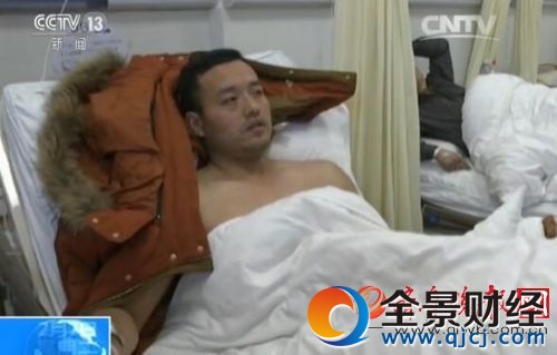 山東小伙火海救三母子:我一只手換三條命,值了! 山東小伙火海救三母子:我一只手換三條命,值了!