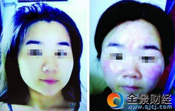 Ů����΢����Ĥ���R���a ѪҺ����@ʾ�U�����������